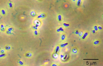 Új baktériumfajt fedeztek fel kutatóink a Szent Anna-tóban